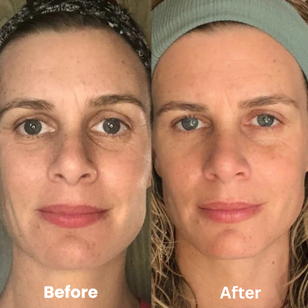 Orvanna Lymphatic Contour Face Brush