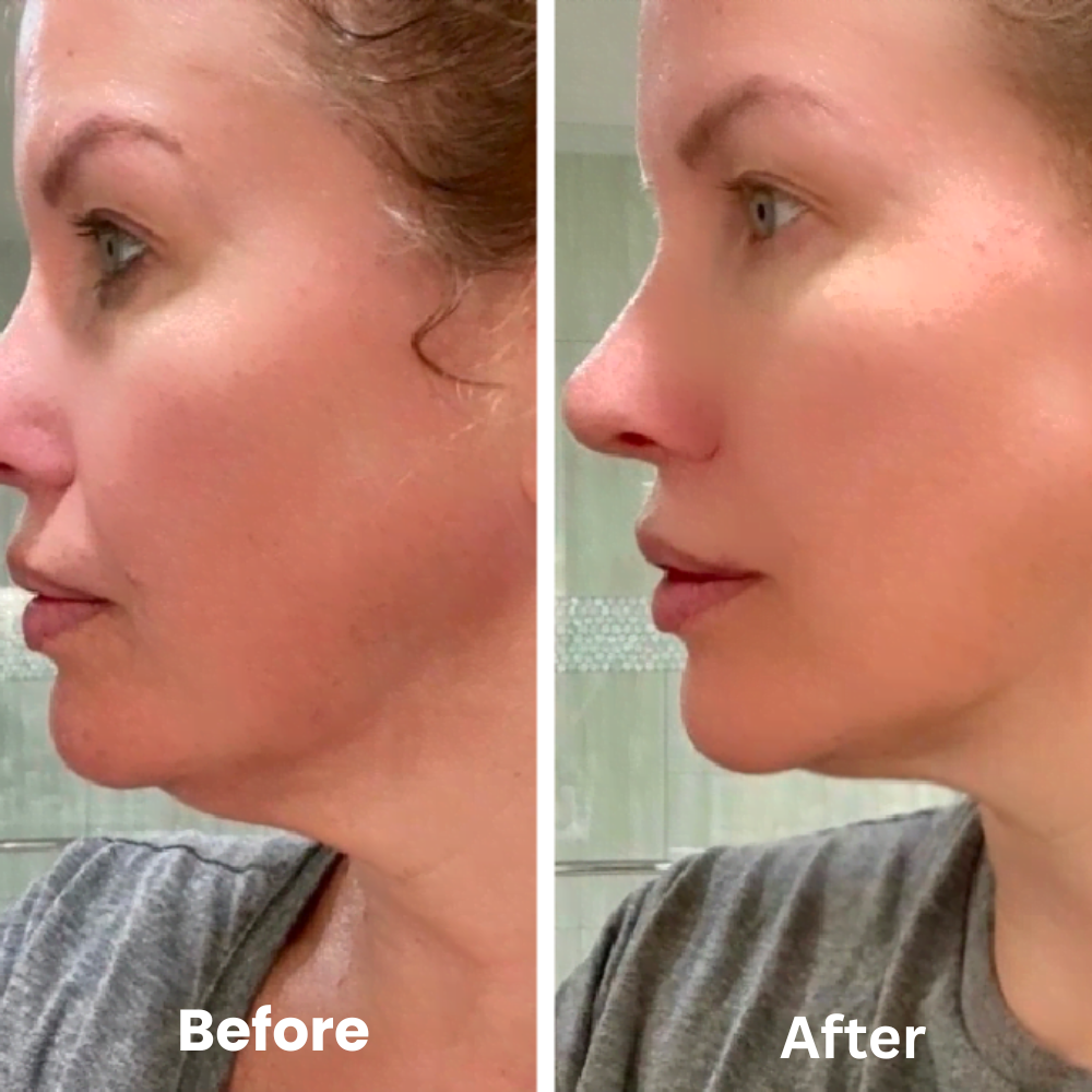 Orvanna Lymphatic Contour Face Brush