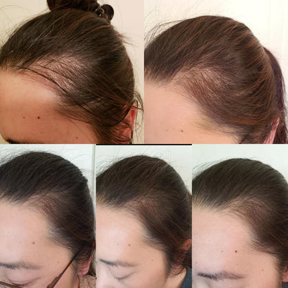 Orvanna Organic Castor Oil Roll-On